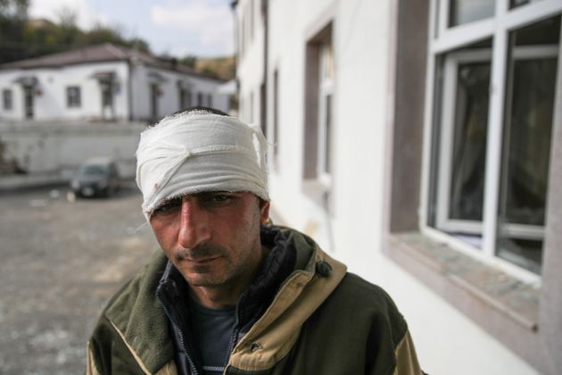 Το Αζερμπαϊτζάν βομβάρδισε στρατιωτικό νοσοκομείο στο Ναγκόρνο